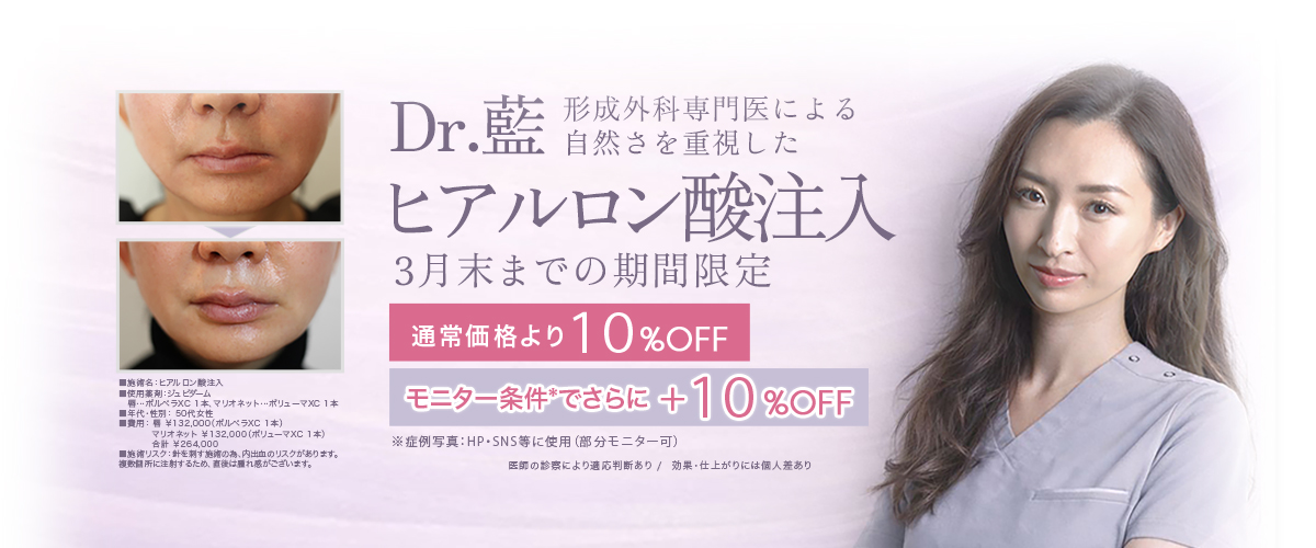 Dr.藍によるヒアルロン酸注入 3月末までの期間限定 通常価格より 10%OFF モニター条件で さらに+10%OFF